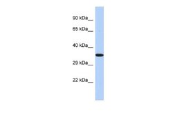 EPHX4 Rabbit anti-Human, Polyclonal, Novus Biologicals 0.1ml; Unconjugated:Antibodies,